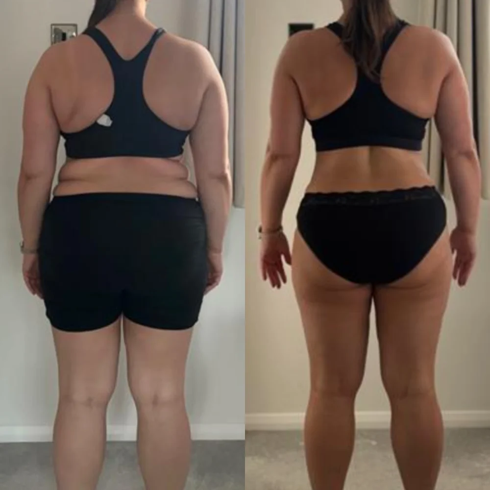Emily transformation